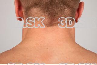 Neck texture of Gene 0002